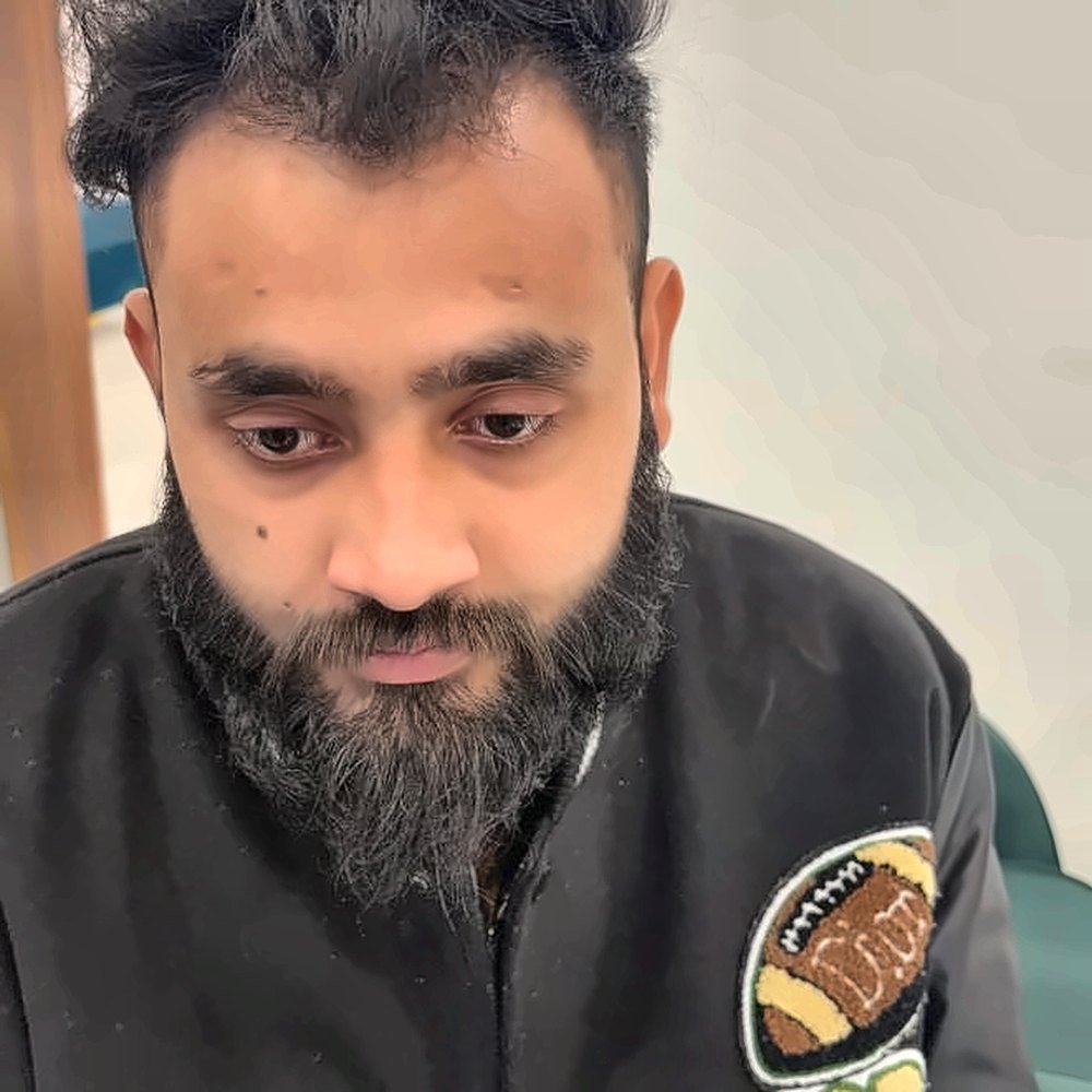 Beard Transplant at SOZO Ghaziabad