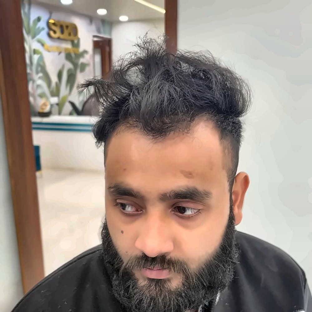 GFC Hair Treatment at SOZO Ghaziabad