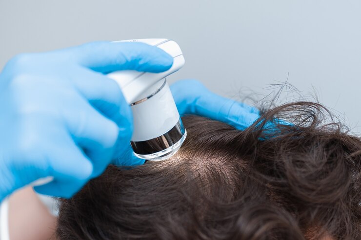 Best Dermatologist for hair loss in Ghaziabad