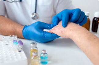 Best Lichen Planus Treatment clinic In Raj Nagar Extension